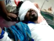 شوہر پر تیزاب پھینکنے کے بعد خاتون آشنا کے ساتھ فرار