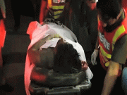 مالک نے تنخواہ مانگنے پر ملازم پر تیزاب پھینک دیا