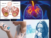 دمہ  علامات  وجوہات اور ہومیوپیتھک علاج