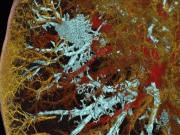 دنیا کی روشن ترین ایکسرے مشین جو سی ٹی اسکین سے بھی 100 گنا بہتر ہے