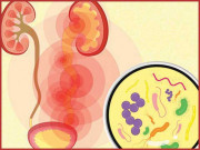 پیشاب کی تکالیف علامات اسباب اور علاج