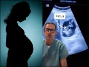 خاتون کے جگر میں حمل ٹھہر گیا