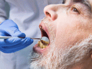 منہ کی بیمارکیفیت کئی جسمانی اور دماغی امراض کی وجہ قرار