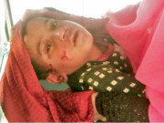 گھر کے باہر آوارہ کتوں کے حملے میں بچی شدید زخمی