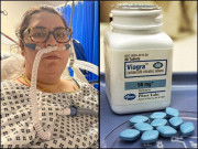 ویاگرا نے کووِڈ 19 سے شدید متاثرہ خاتون کی جان بچا لی