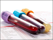 خون کیسے صاف کیا جائے