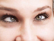 بھینگا پن کیا ہے