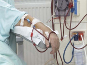 گردوں کی بیماری اور کینسر کے درمیان تعلق