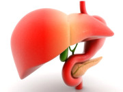 fatty liver  جگر کے خلیوں کے لیے نقصان دہ چربی