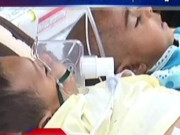 تھر میں قحط سالی غذائی قلتایک ماہ میں 32 بچے زندگی کی بازی ہار گئے