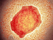 سائنس دانوں کا ’منکی پاکس‘ کے لیے غیر امتیازی نام کا مطالبہ