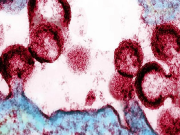 خطرناک ٹرانسپلانٹ کے بعد ایچ آئی وی اور لیوکیمیا کا چوتھا مریض صحت یاب