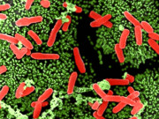 کلوسٹرڈیم ڈیفیسائل آنتوں کے اس انفیکشن کو مفید بیکٹیریا کی مدد سے دور کیا جاسکتا ہے