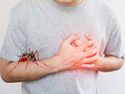 دل کے مریضوں کیلیے ڈینگی مچھر انتہائی خطرناک قرار