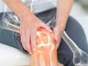 آسٹیوپوروسس سے ہر سال ہڈی ٹوٹنے کے 80 لاکھ واقعات رونما ہوتے ہیں ڈاکٹر روبینہ