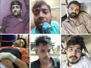 کراچی میں پولیس مقابلوں کے بعد 8 ڈاکو زخمی حالت میں گرفتار