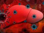 پاکستان میں ہیپاٹائٹس سی کے مریضوں کی تعداد ایک کروڑ تک پہنچ گئی