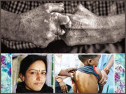 کوڑھ یعنی جزام