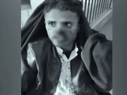 مظفرگڑھ میں غیرت کے نام پر نوجوان کی ناک کاٹ دی گئی