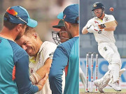 ڈیوڈ وارنر سر پر چوٹ کے ساتھ کہنی بھی فریکچر کروا بیٹھے