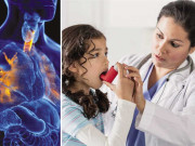 دمہ کی علامات اور اسباب