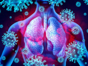 75 فیصد متعدی بیماریاں جانوروں سے پھیلتی ہیں رپورٹ