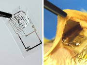 جسم میں تحلیل ہوجانے والے برقی آلات زخموں کو انفیکشن سے محفوظ رکھیں گے