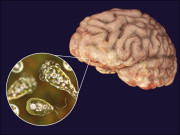 سندھ میں نیگلیریا سے رواں سال کی چوتھی موت، 17 سالہ طالب علم کو دماغی جرثومے نے مار ڈالا