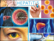 ہیپاٹائٹس تشخیص احتیاطی تدابیر اور علاج