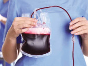 نوجوانوں کا خون کیا بوڑھے کو جوان بنا سکتا ہے