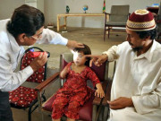 ضلع بدین میں آشوب چشم کی وبا پھیل گئی سیکڑوں افراد مرض میں مبتلا