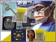 انسانی دماغ میں زندہ کیڑا نکل آیا