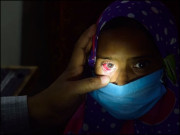 اندھے علاج نے آنکھوں سے روشنی چھین لی