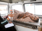 کورنگی باسی کھانا کھانے والے 100 باراتی بیمار ہوگئے