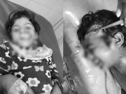 لاہور میں آوارہ کتوں نے 6 بچوں کو کاٹ لیا