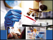 ایڈز تشخیص احتیاط اور علاج