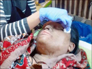 پنجاب تیزاب گردی کا شکار افراد کیلیے ’’نئی زندگی پروگرام‘‘ فعال