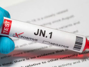 کورونا جے این ویریئنٹ کے مزید دو کیسز رپورٹ تعداد 7 تک پہنچ گئی