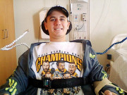 فالج کا حملہ 