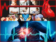 ہارٹ اٹیک کی خاموش علامات