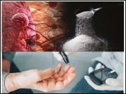 کیا چینی کینسر پیدا کرتی ہے