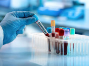 کے ایم سی نے ڈیجیٹل ہیلتھ کیئر لیبارٹری کا آغاز کردیا