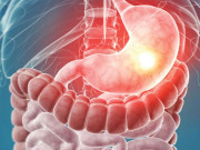 بقر عید کے دنوں اور بعد کے ایام میں پیٹ کے امراض کیوں بڑھ جاتے ہیں