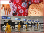 ایم پاکس تعارف احتیاطی تدابیر اور علاج