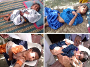 سانگھڑ کے دیہات میں پراسرار بیماری سے 3 بچے ہلاک 30 معذور