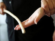 راولپنڈی میں سرکاری اسکول کے پرنسپل کا طالبعلم پر تشدد کندھے کی ہڈی توڑ دی