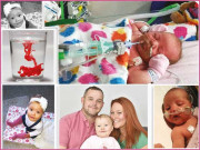 عجیب پیدائشی بیماری کا معجزاتی علاج