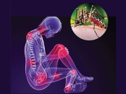 پشاور میں چکن گونیا وبا کی صورت اختیار کرگیا