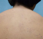 ہوشیار آئی پیڈ اورٹیبلٹ کا مسلسل استعمال بن سکتا ہے الرجی کا باعث