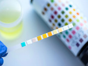 سندھ حکومت کا تعلیمی اداروں میں طلبا کے منشیات ٹیسٹ کرنے کا فیصلہ